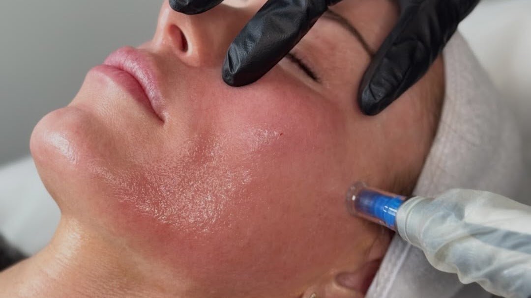 Blush Laser & Skin Clinic